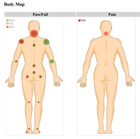 Exam Xoom body map showing pass/fail findings and pain locations across anterior and posterior views
